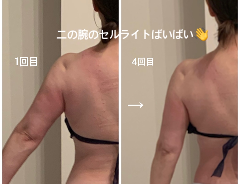 2年前くらいに3万円で買いました、ほぼ使っていません、脂肪をモミモミ痩身機械 p800x600_3c74f433.jpeg