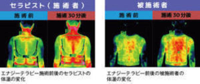 Prana エナジーテラピーセグイートシステム 動作確認済み エナジーテラピーで血流促進