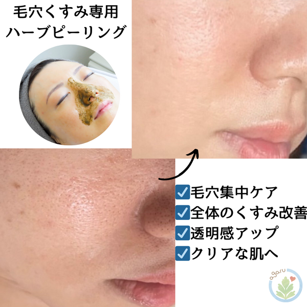未開封・複数箱可】on:myskin オンマイスキン ハーブピーリング