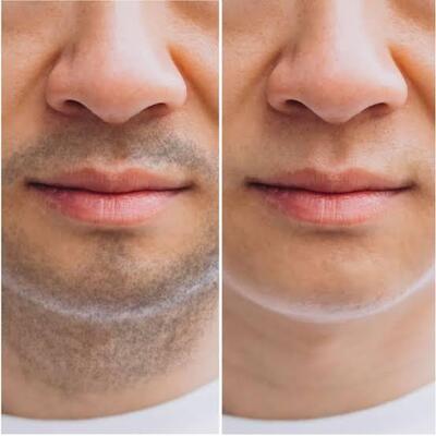 ヒゲ富士 thumb_66efacdf.jpeg