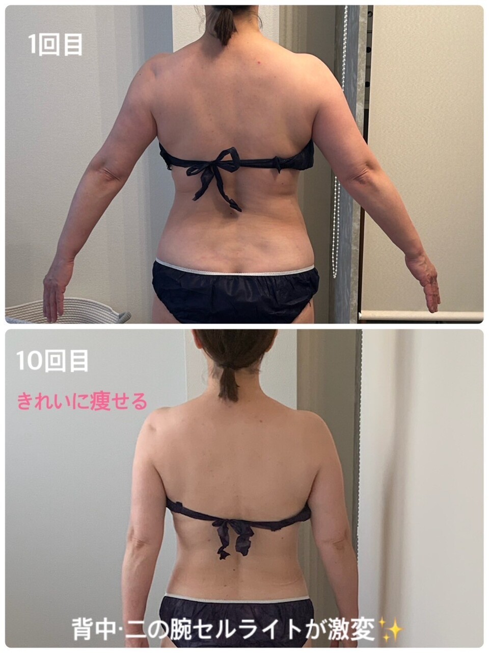 2年前くらいに3万円で買いました、ほぼ使っていません、脂肪をモミモミ痩身機械 2年前くらいに3万円で買いました、ほぼ使っていませ