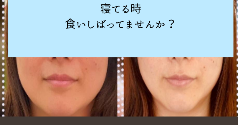サイズダウンレボリューション