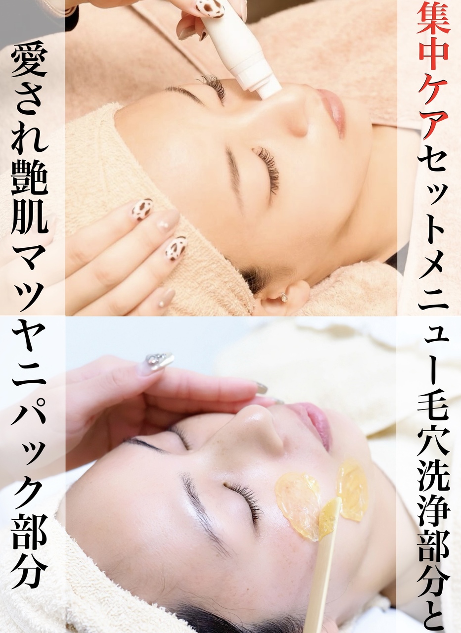 ハイドロフェイシャル　オーラルフェイス毛穴ケア ハイドロフェイシャル オーラルフェイス毛穴ケア ハイドラ