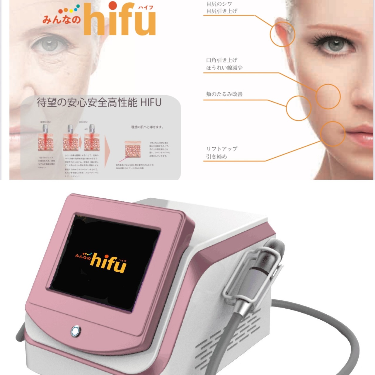 京丹後市 土足で入れるサロン セルフエステ HIFU ハイフ エレクトロポ