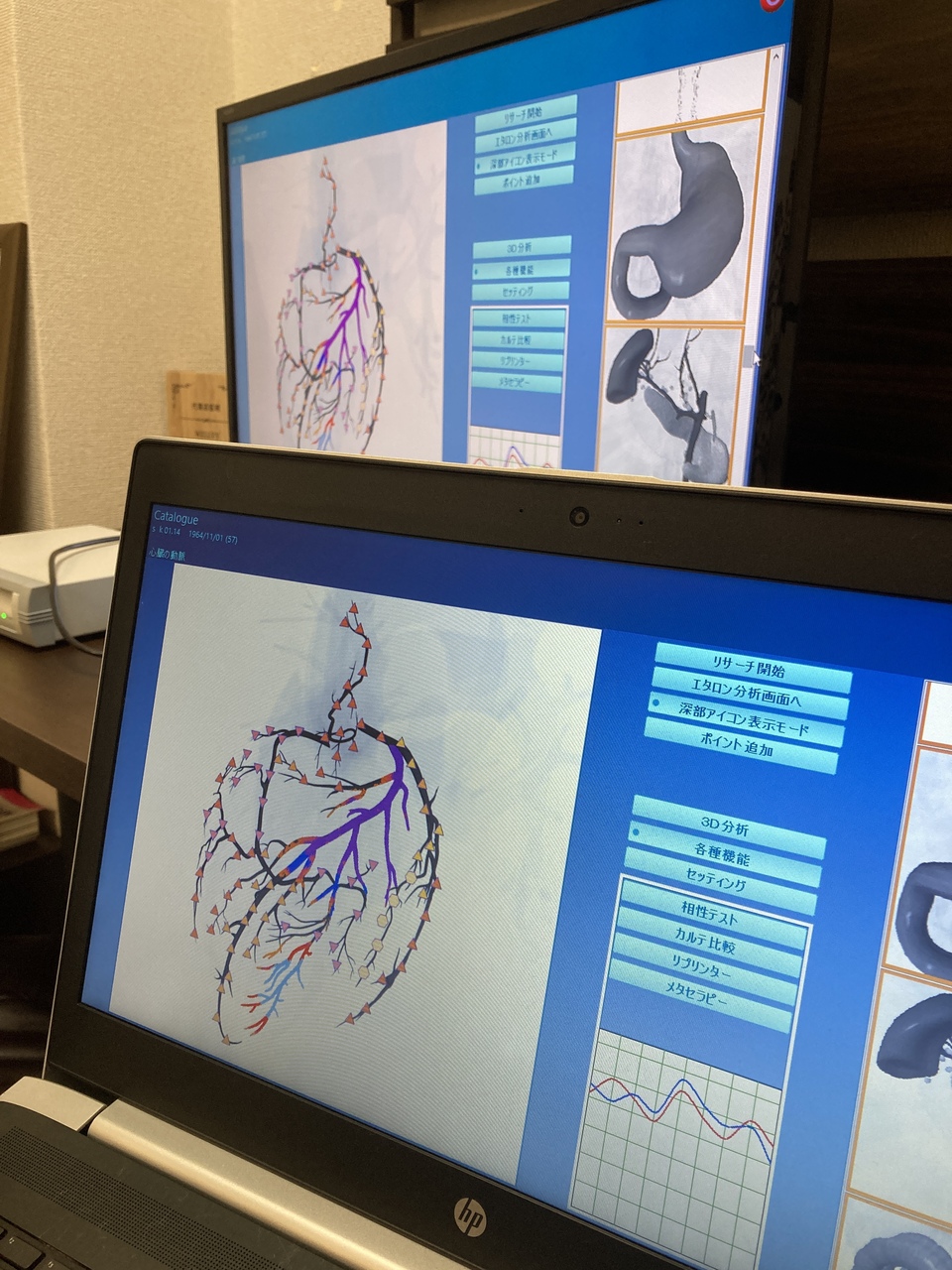 西新宿 徒歩1分｜未来の人間ドック『メタトロン』｜驚愕の波動解析を