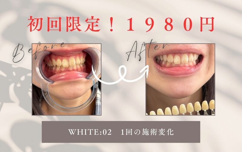 WHITE：02 八丁堀 セルフホワイトニングサロンの月謝・回数券