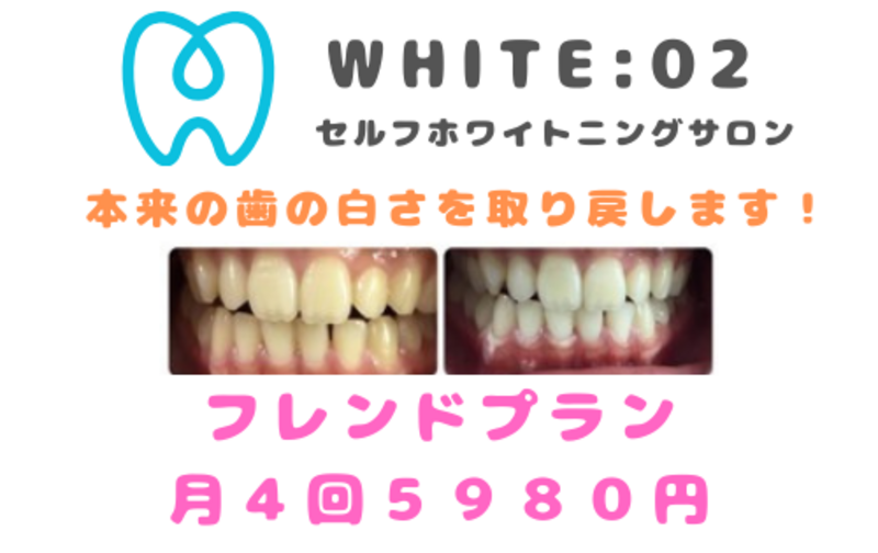 WHITE：02 八丁堀 セルフホワイトニングサロンの月謝・回数券