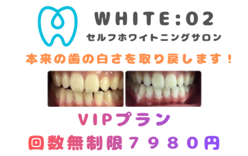 WHITE：02 八丁堀 セルフホワイトニングサロンの月謝・回数券