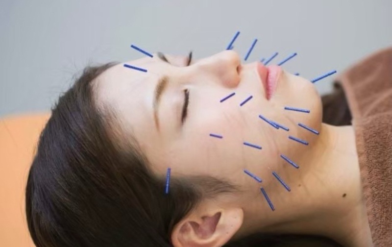 FUJIYAMA 3S鍼灸プレミアムパス(翌月払い)※定員制