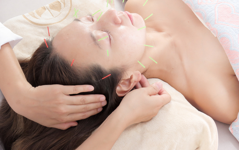 🌸開業キャンペーン🌸  美容鍼灸＋全身鍼灸 たっぷり90分コース〈5回数券〉