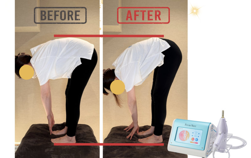 フィジオショット10回券→期間限定11回)