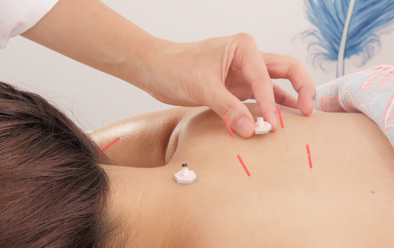 🍀オーダーメイト鍼灸治療　たっぷり90分コース🍀　【５回数券】