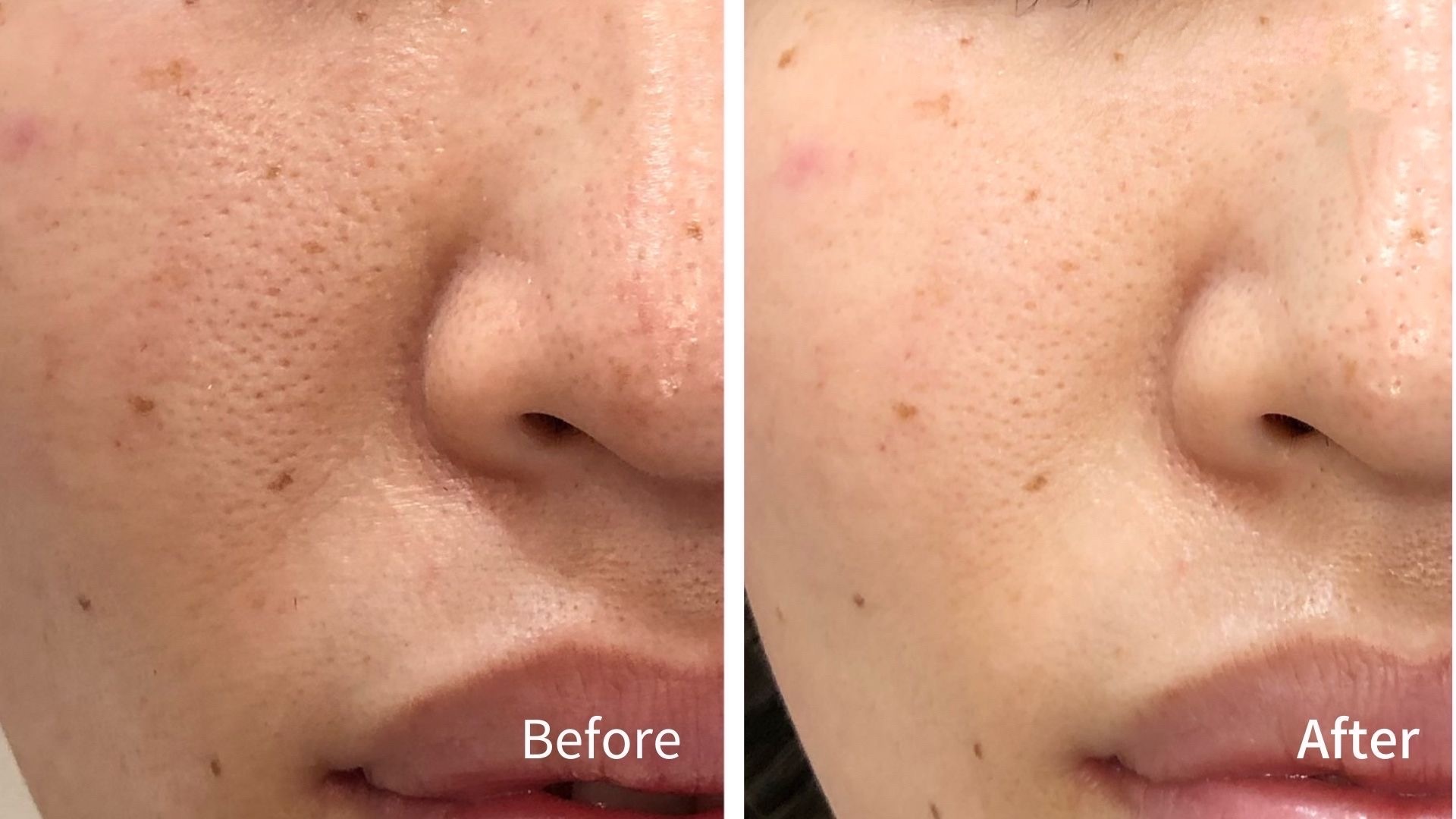 拡大鏡エステ　アイサロン　毛穴サロン　廃盤品 楽天市場】ライト 拡大鏡 エステの通販