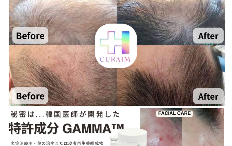 韓国育毛CURAIM ライトコース（月1回）