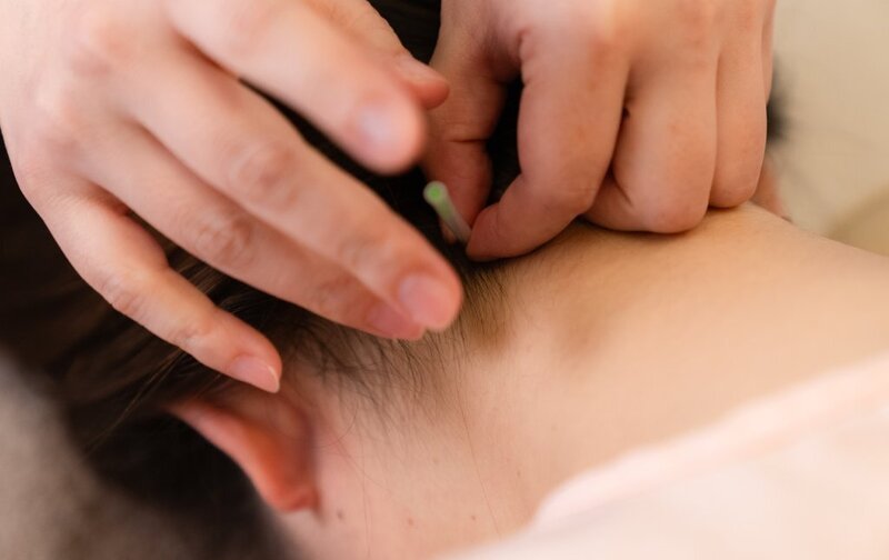 全身鍼灸回数券（1回）