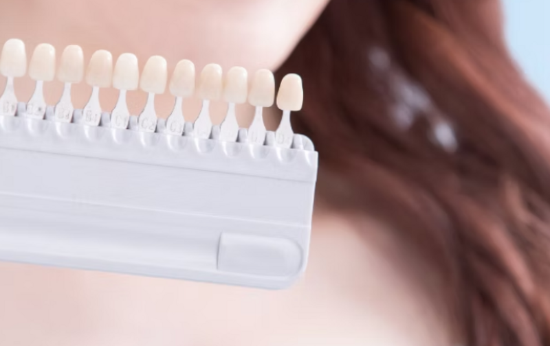 セルフホワイトニング 15分×3回　＋おまけ１回。