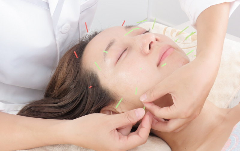 🌿美容鍼灸45分コース〈5回数券〉🌿