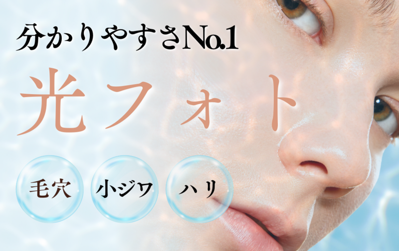 フォトフェイシャル　３回　回数券