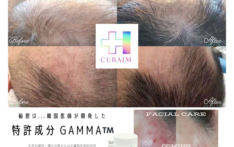 韓国育毛CURAIM 本気コース（月2回）