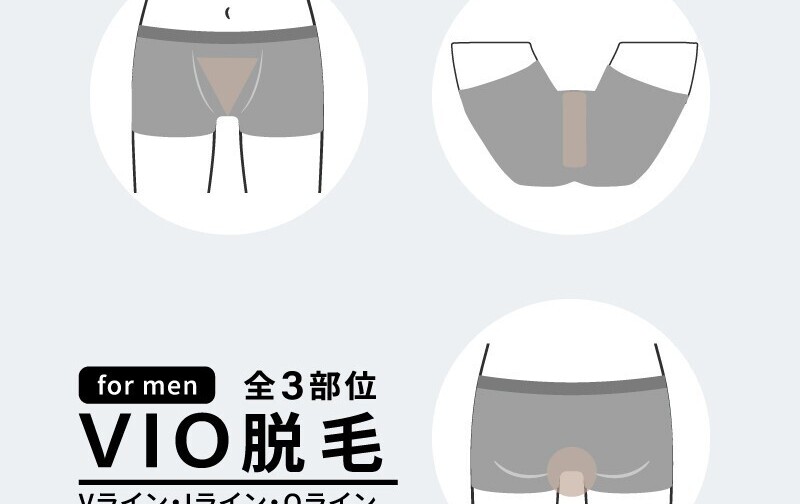 VIO脱毛セット回数券 