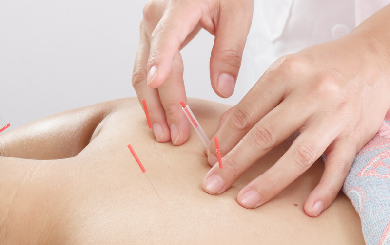 🌿全身鍼灸60分コース〈5回数券〉🌿