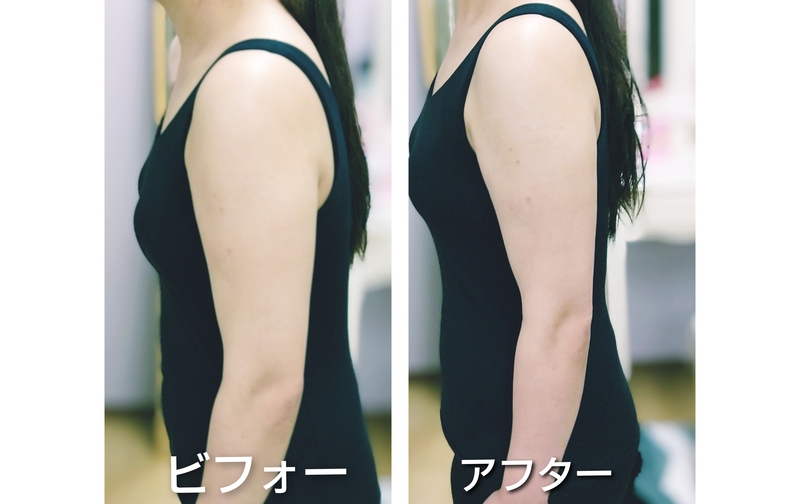 6回チケット前かがみ姿勢起立リンパ90分