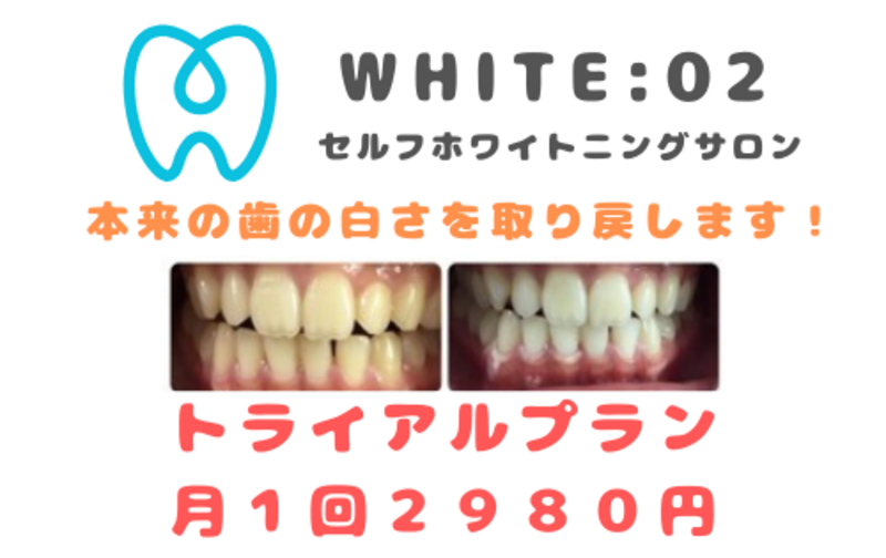 WHITE:02 八丁堀 セルフホワイトニングサロンの月謝・回数券 WHITE:02 八丁堀 セルフホワイトニングサロンの月謝・回数券