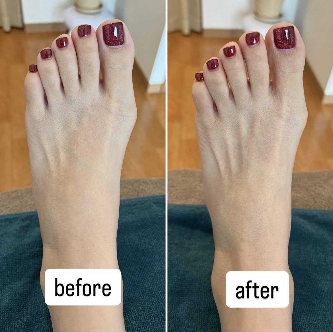 ▶︎▶︎台湾式足つぼ