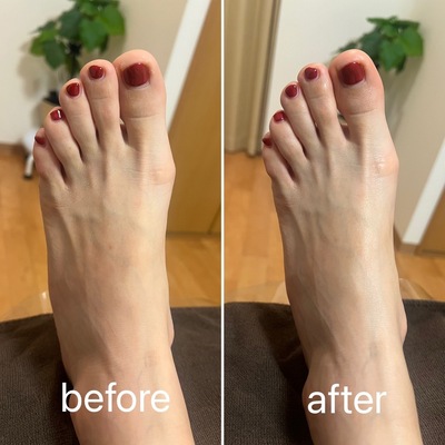 ▶︎▶︎台湾式足つぼ