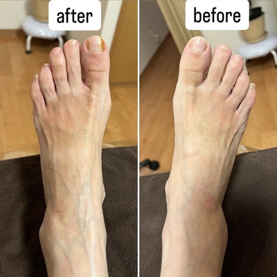 ▶︎▶︎台湾式足つぼ