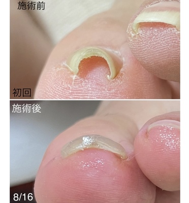 家族の爪ケア専門店　カルミア　予約はこちらから