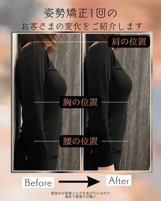 初回限定☆肌質改善美肌脱毛＋小顔メニュー無料体験