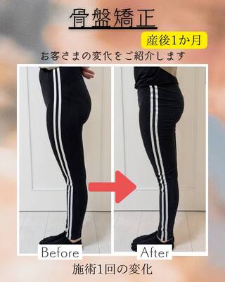 初回限定☆肌質改善美肌脱毛＋小顔メニュー無料体験