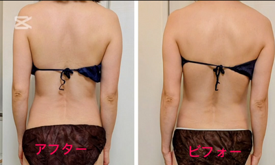 小顔サロン　カリーナの予約ページ