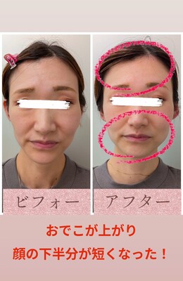 小顔サロン　カリーナの予約ページ