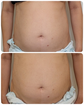 小顔サロン　カリーナの予約ページ