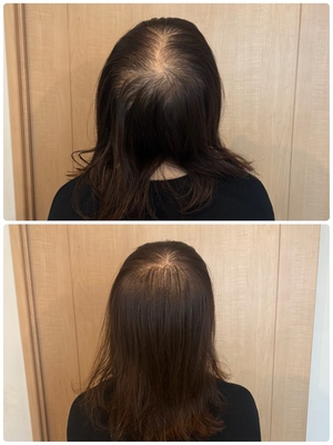 熊本市東区｜増毛エクステ×まつげ×眉｜大人女性の美サロンJupiter