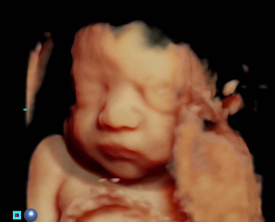 4D Ultrasound session (15weeks~)