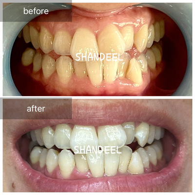 SHANDEEL予約受付ページ