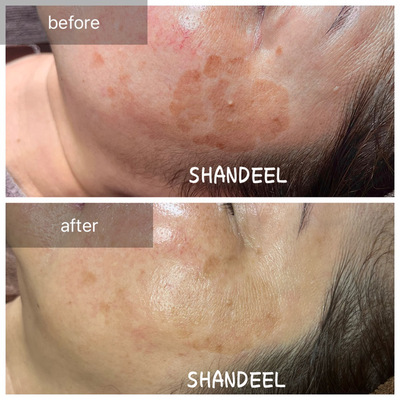 SHANDEEL予約受付ページ