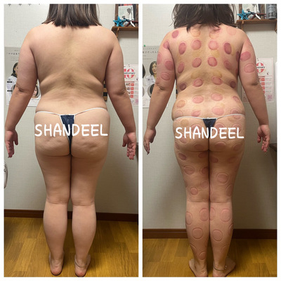 SHANDEEL予約受付ページ