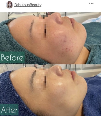 【フェイシャル】