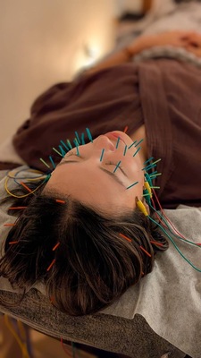 【30分】美容鍼/Noriko