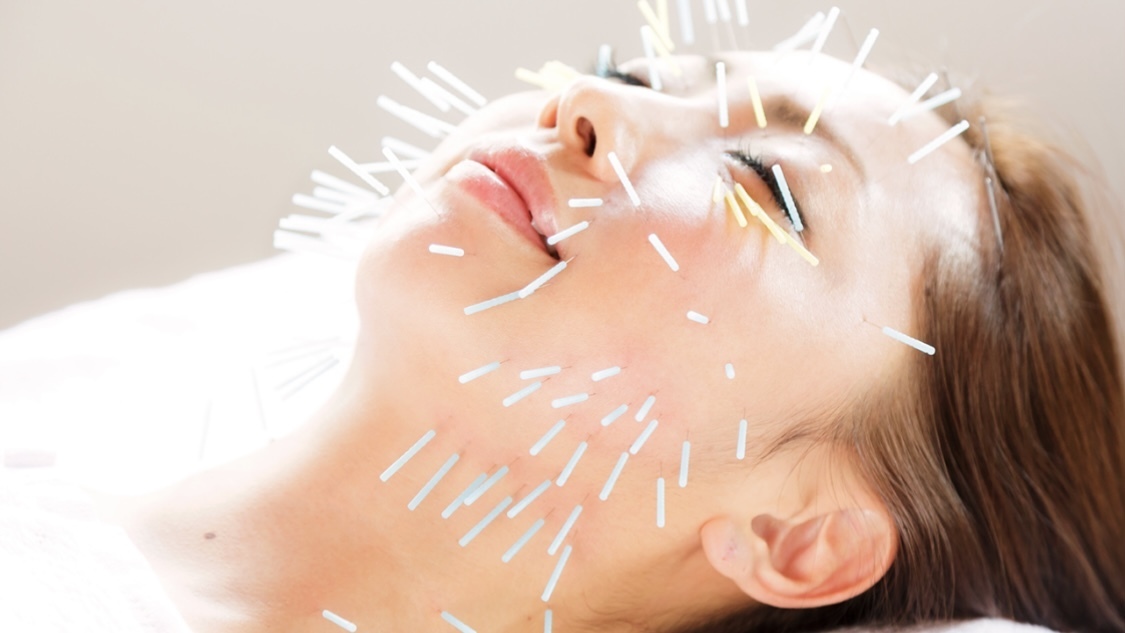 美容鍼灸ご予約ページ