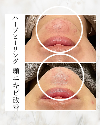 ご予約はこちら