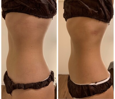 ご予約はこちら