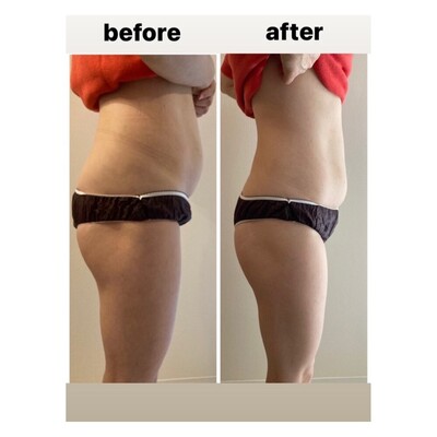 ご予約はこちら