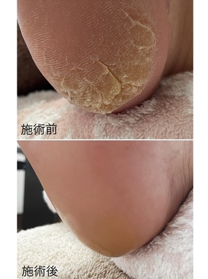 ご予約はこちらをタップ