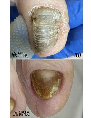 ご予約はこちらをタップ