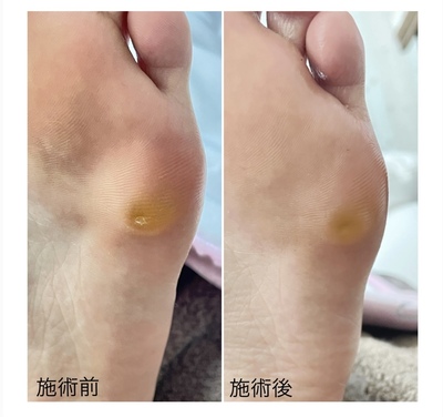 ご予約はこちらをタップ